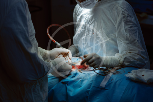 Нейрохирургия